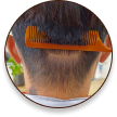 cấy ghép tóc y học