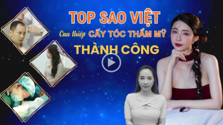 TOP SAO VIỆT CẤY TÓC THẨM MỸ THÀNH CÔNG