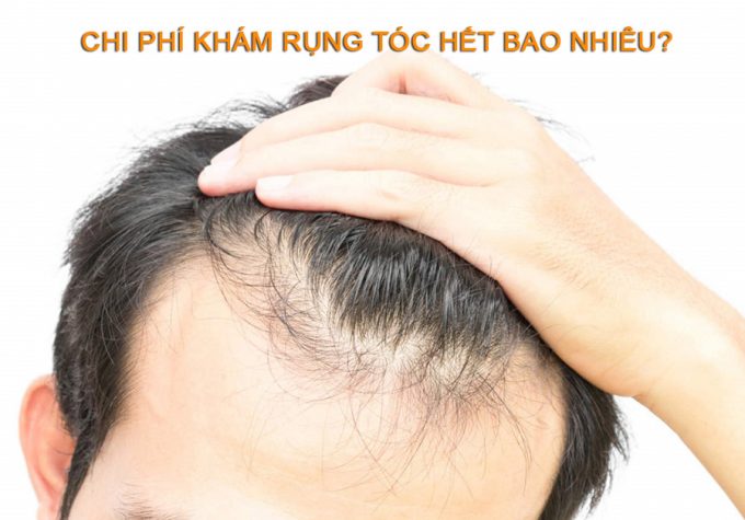 Chi phí khám rụng tóc hết bao nhiêu? Mách bạn địa chỉ khám rụng tóc uy tín