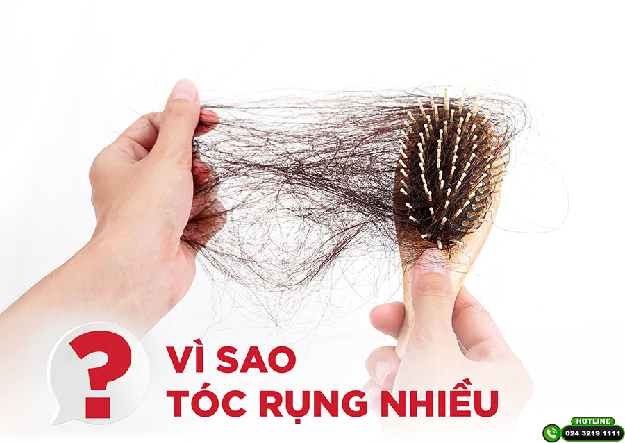 rụng tóc nhiều có nên đi khám không