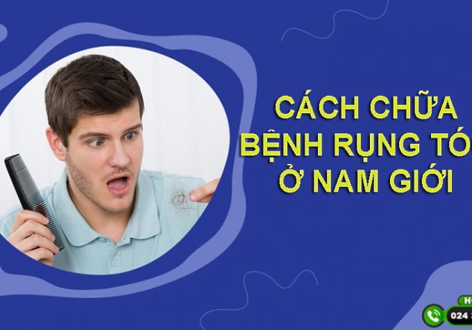 Mách bạn cách chữa bệnh rụng tóc ở nam giới hiệu quả nhất