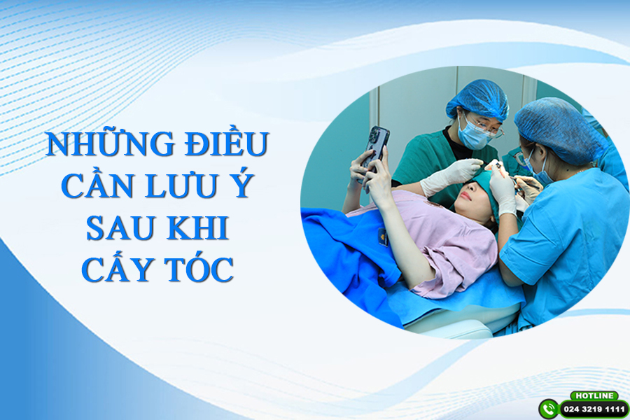 cấy tóc mất bao lâu