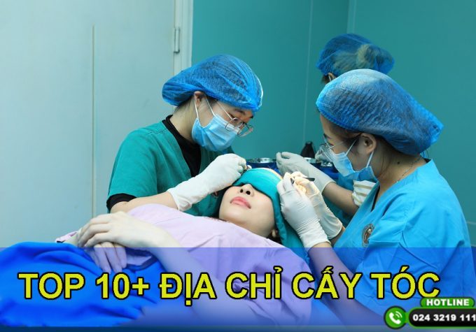 TOP 10+ địa chỉ cấy tóc uy tín tại Hà Nội và TP. HCM