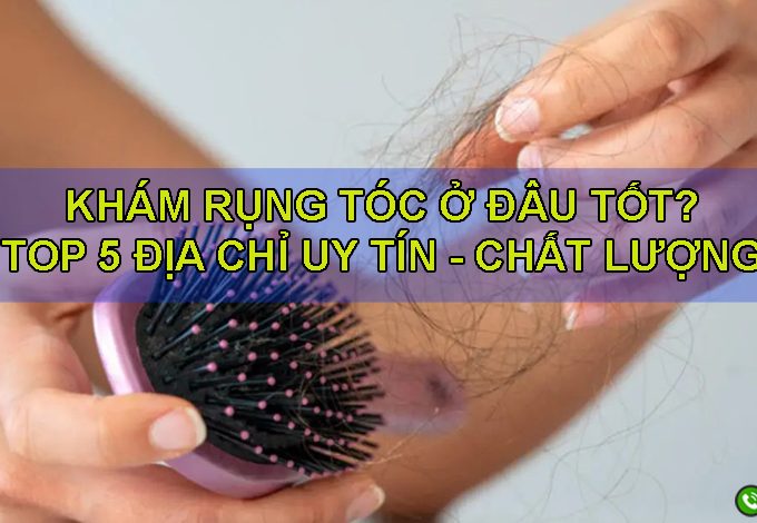 Khám rụng tóc ở đâu tốt? Top 5 địa chỉ khám rụng tóc uy tín nhất hiện nay