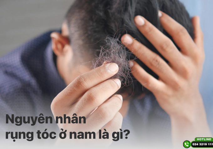 Nguyên nhân bị rụng tóc ở nam và giải pháp khắc phục hiệu quả