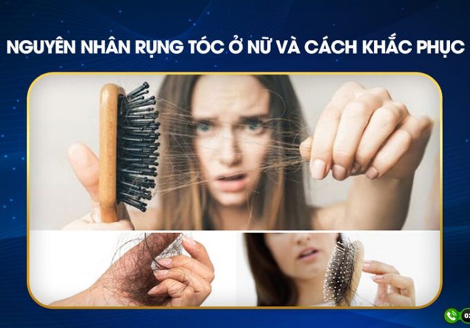 Điểm mặt nguyên nhân bị rụng tóc ở nữ và cách khắc phục