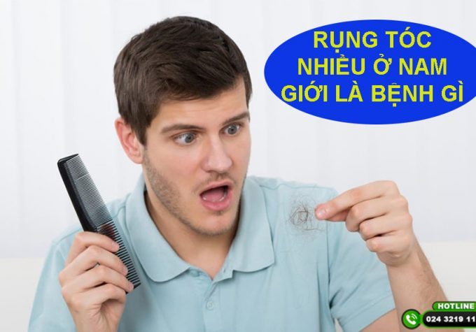 [Tìm Hiểu] : Rụng tóc nhiều ở nam giới là bệnh gì?