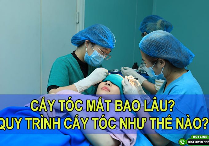 Một ca cấy tóc mất bao lâu? Cận cảnh quy trình thực hiện