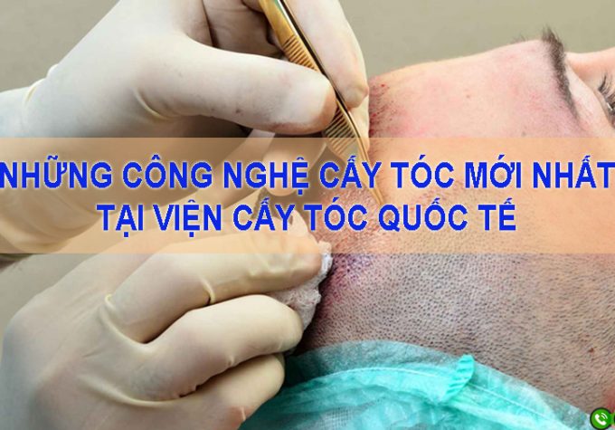 Cập nhật những công nghệ cấy tóc mới nhất tại Viện Cấy tóc Quốc tế