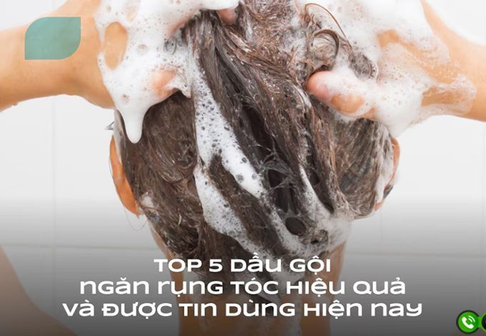 TOP 5 dầu gội ngăn ngừa rụng tóc cho nữ được người Việt tin dùng