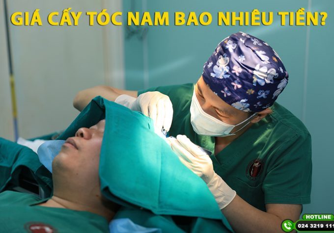 Giá cấy tóc nam bao nhiêu tiền? Bảng giá cấy tóc nam tại Viện Cấy tóc Quốc tế 