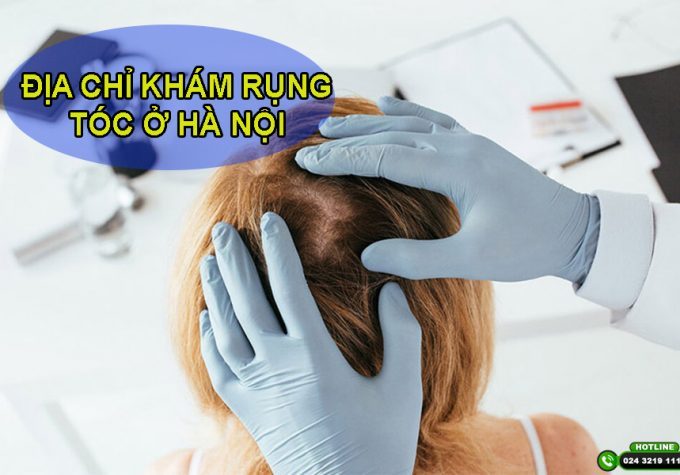 Khám rụng tóc ở đâu Hà Nội? Top 5 địa chỉ tốt nhất