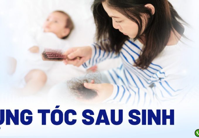 [Giải Đáp] : Rụng tóc sau sinh nên làm gì?