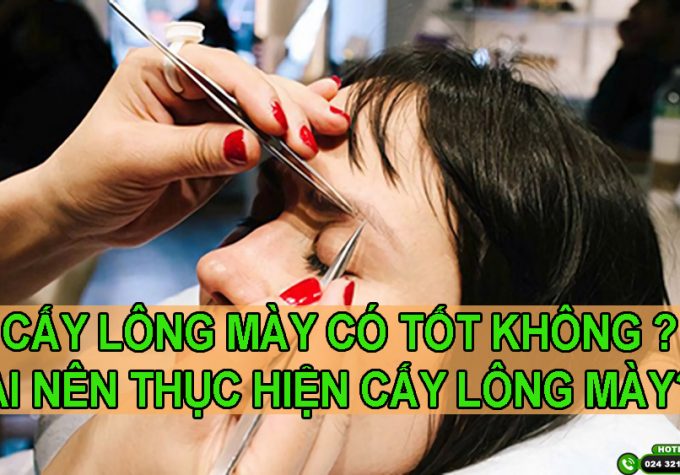 Chuyên gia giải đáp: Cấy lông mày có tốt không? Ai nên thực hiện?