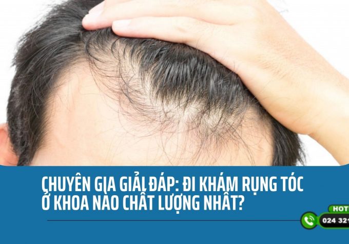 Chuyên gia giải đáp: đi khám rụng tóc ở khoa nào chất lượng nhất? 