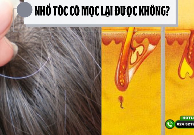 Nhổ tóc có mọc lại được không? Cách chữa tóc không mọc lại sau nhổ 