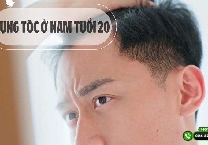 Rụng tóc ở nam tuổi 20: dấu hiệu, nguyên nhân, cách phòng ngừa và điều trị.