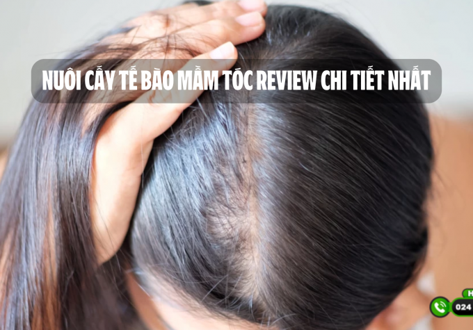 Nuôi cấy tế bào mầm tóc review chi tiết nhất: quy trình cấy, đánh giá ưu – nhược điểm, có hiệu quả như lời đồn? 