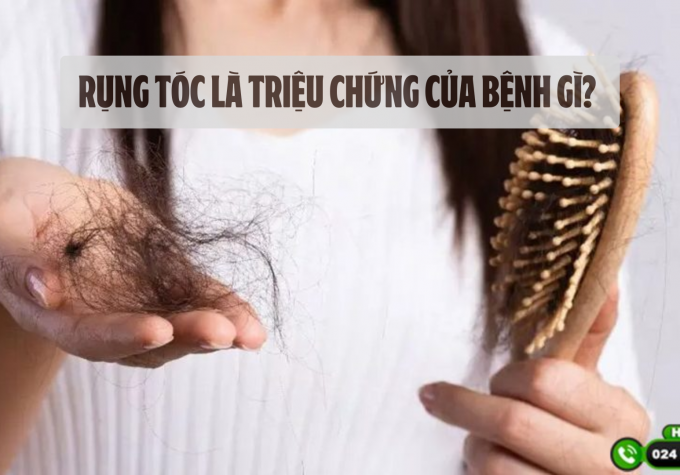 Rụng tóc là triệu chứng của bệnh gì? Cách điều trị chứng rụng tóc nhiều