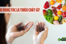 Bị rụng tóc là thiếu chất gì? Các loại thực phẩm giàu dưỡng chất giúp tóc luôn khỏe đẹp