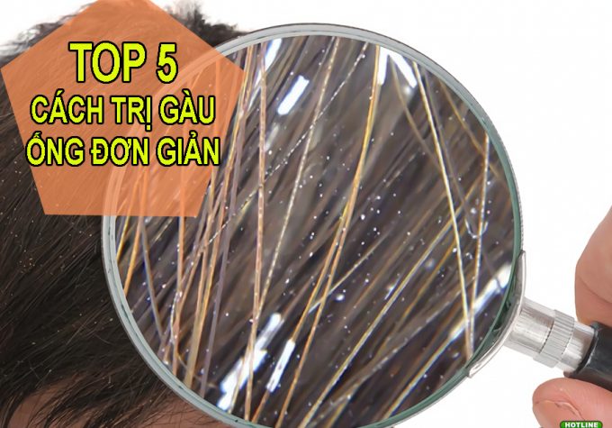 TOP 5 cách trị gàu ống đơn giản và hiệu quả tại nhà