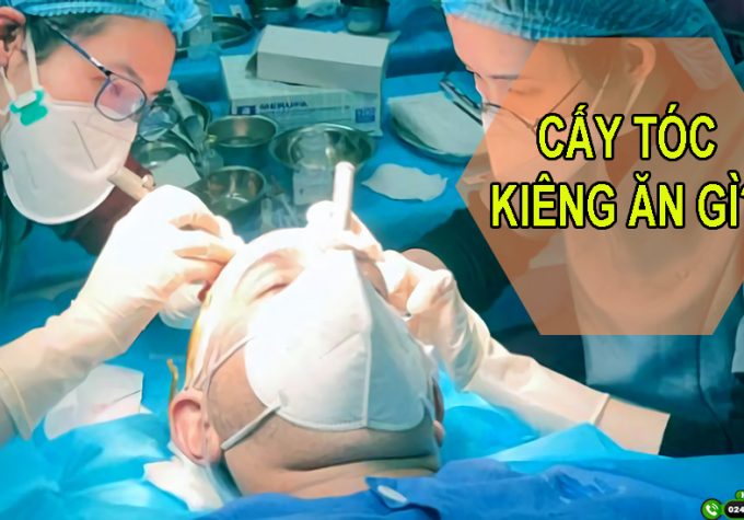 Cấy tóc kiêng ăn gì để phục hồi nhanh và hạn chế biến chứng