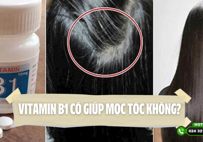 Vitamin B1 có giúp mọc tóc không? Bác sĩ chuyên khoa giải đáp chi tiết 