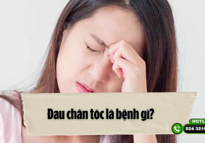 Đau chân tóc là bệnh gì? Các phương pháp điều trị bệnh đau chân tóc 