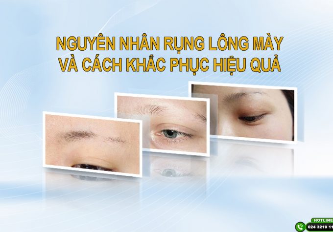 Nguyên nhân rụng lông mày và cách khắc phục hiệu quả