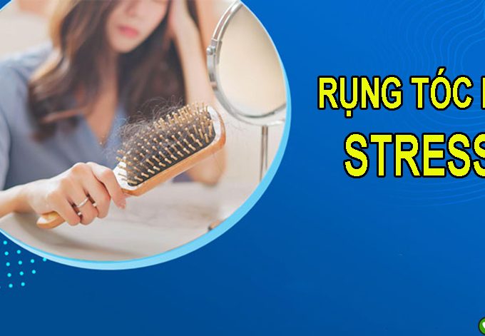 Đừng chủ quan khi bị rụng tóc do stress