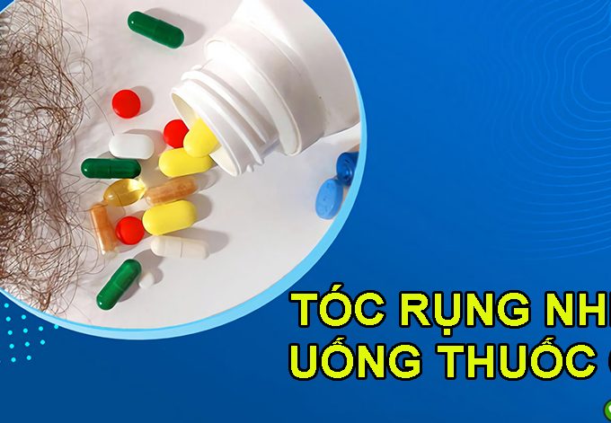 Tóc rụng nhiều uống thuốc gì? TOP 5 sản phẩm trị rụng tóc được ưa chuộng nhất