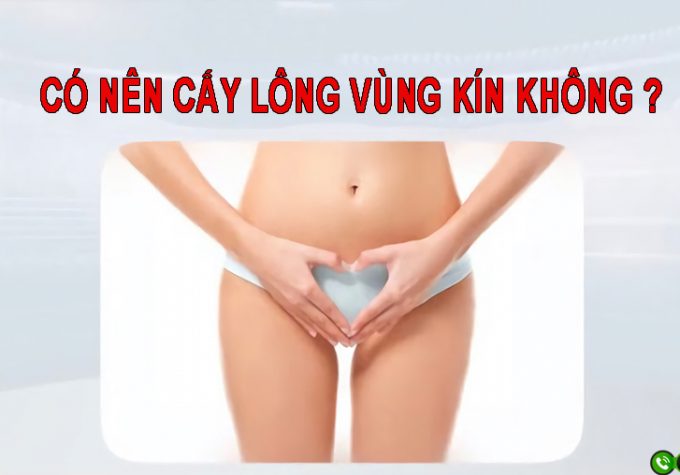 GIẢI ĐÁP : CÓ NÊN CẤY LÔNG VÙNG KÍN KHÔNG ?