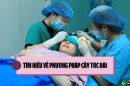 Tìm hiểu về phương pháp cấy tóc dài: phương pháp cấy tóc tiên tiến nhất hiện nay