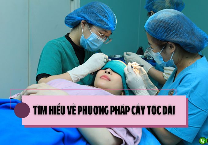 Tìm hiểu về phương pháp cấy tóc dài: phương pháp cấy tóc tiên tiến nhất hiện nay