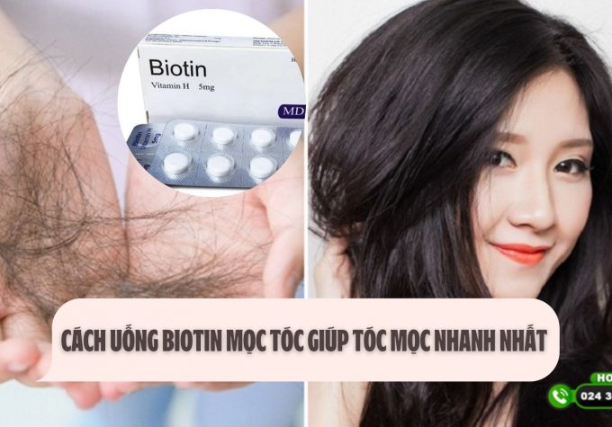 Cách uống biotin mọc tóc giúp tóc mọc nhanh nhất 