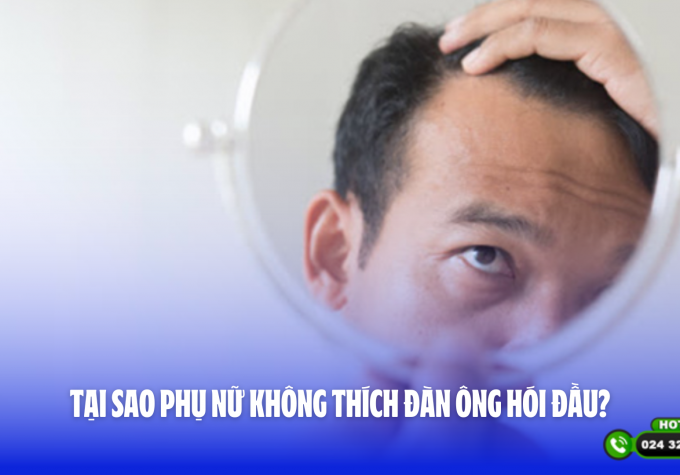 Tại sao phụ nữ không thích đàn ông hói đầu?