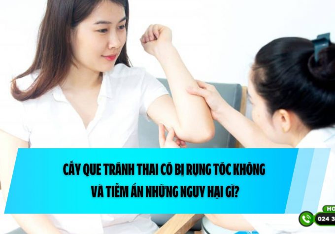 Cấy que tránh thai có bị rụng tóc không và tiềm ẩn những nguy hại gì?