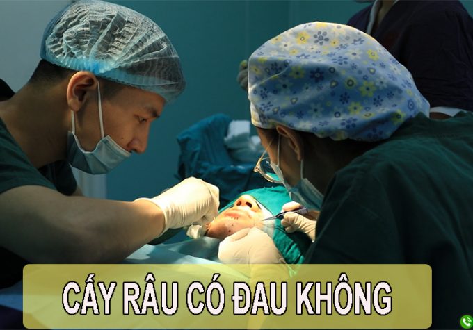 Cấy râu có đau không? Chuyên gia giải đáp chi tiết nhất!