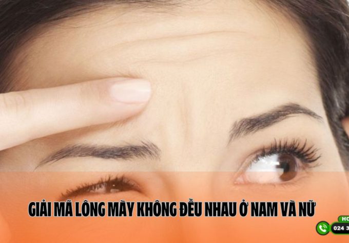 Giải mã lông mày không đều nhau ở nam và nữ, cách khắc phục hiệu quả nhất 