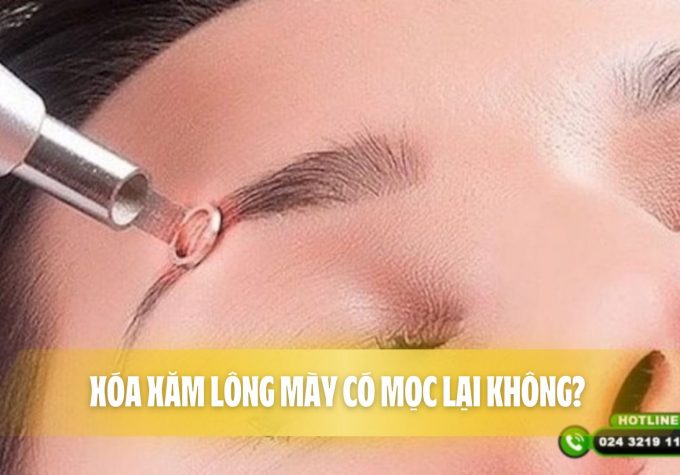 Xóa xăm lông mày có mọc lại không? Những lưu ý khi xóa xăm lông mày  