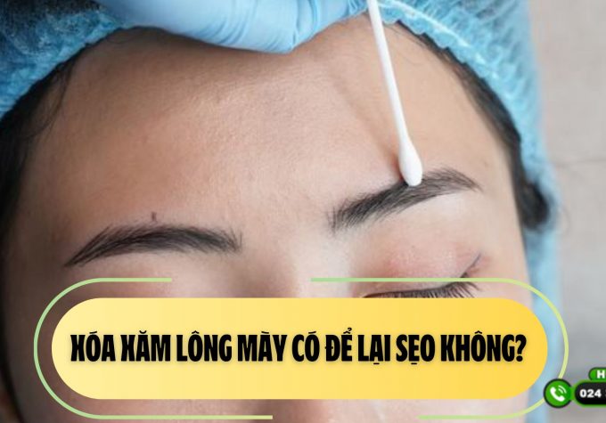 Xóa xăm lông mày có để lại sẹo không? Những lưu ý khi thực hiện