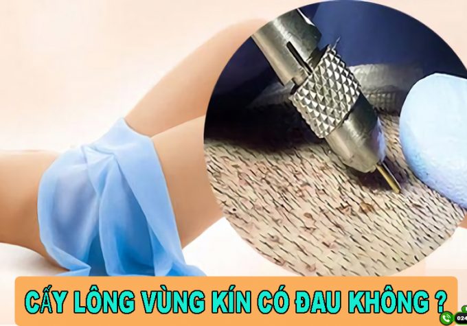 Cấy lông vùng kín có đau không? Cấy lông vùng kín ở đâu tốt, uy tín?