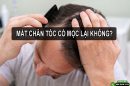 Mất chân tóc có mọc lại không? Phương pháp giúp tái tạo chân tóc hiệu quả