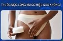 [Giải đáp]: Thuốc mọc lông mu có hiệu quả không?