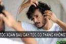 Giải đáp thắc mắc: Tóc xoăn tự nhiên cấy tóc có thẳng không?