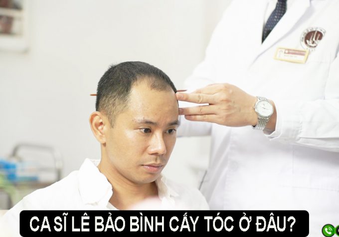 Ca sĩ Lê Bảo Bình cấy tóc ở đâu? Địa điểm uy tín được tiết lộ!