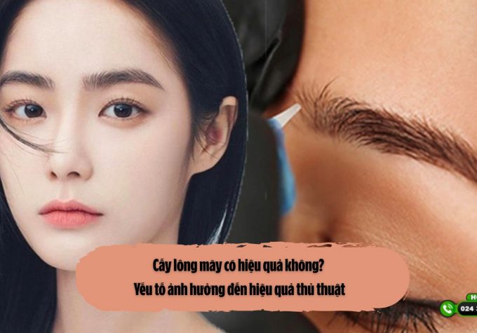 Cấy lông mày có hiệu quả không? Yếu tố ảnh hưởng đến hiệu quả thủ thuật