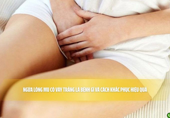 Ngứa lông mu có vảy trắng là bệnh gì và cách khắc phục hiệu quả