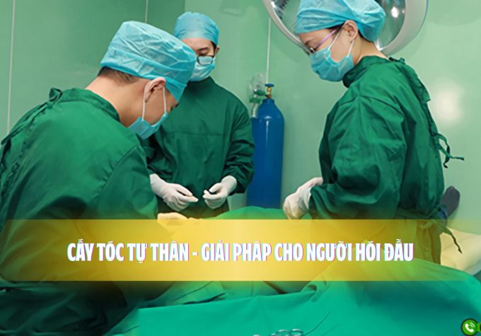Cấy tóc tự thân – Giải pháp cho người hói đầu