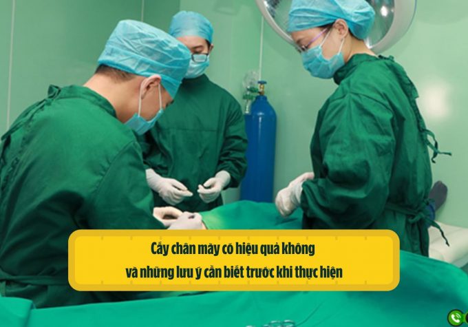 Cấy chân mày có hiệu quả không và những lưu ý cần biết trước khi thực hiện